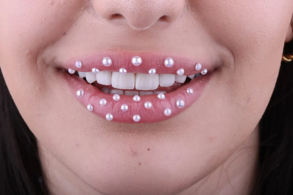 Diş Estetiğinde Kullanılan Porselen Laminalar Nasıl Sökülür