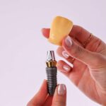 İmplant Üstü kaplamalar