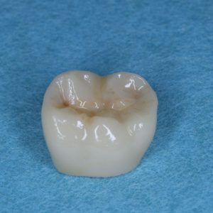 Ankara Zirkonyum Tedavisi