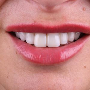 WhatsApp Image 2026-02-10 at 10.34.47 (1)